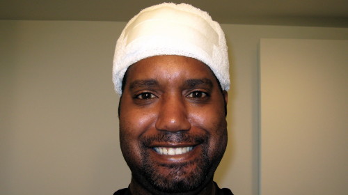 me, the morning after my biopsy. eyes still a little glazed over.